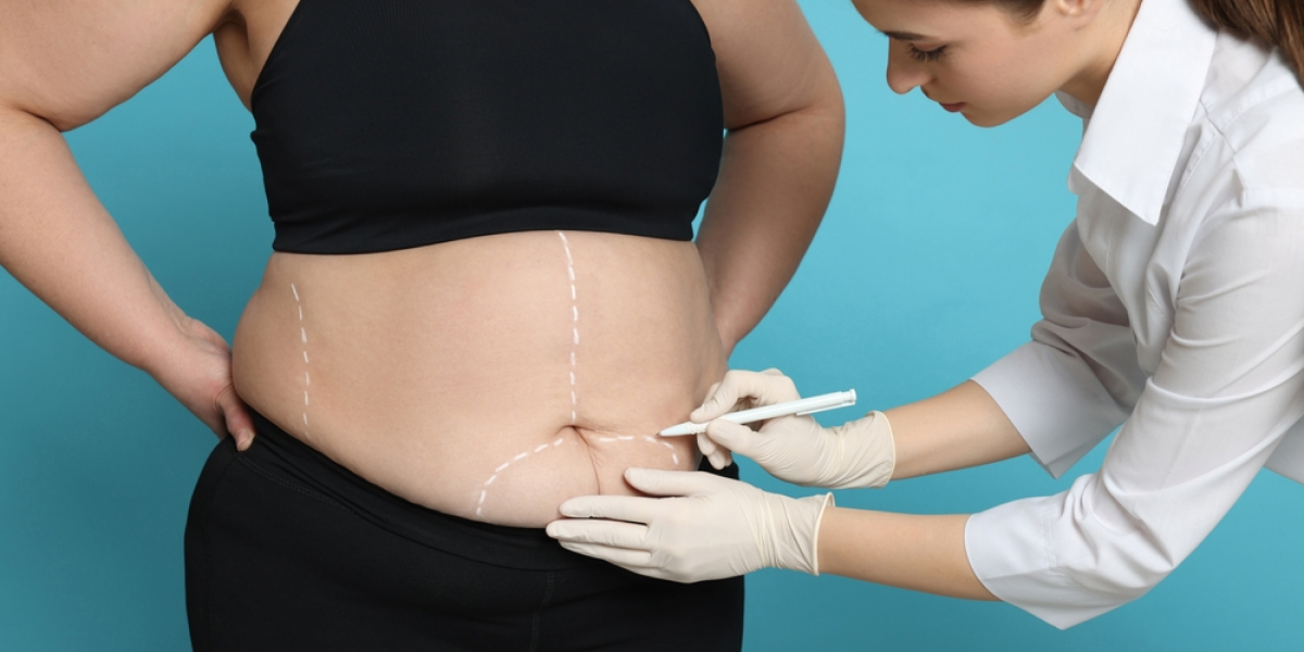 7 essential diet tips after bariatric surgery 7 essential diet tips after bariatric surgery