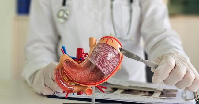 bariatric surgery bariatric surgery